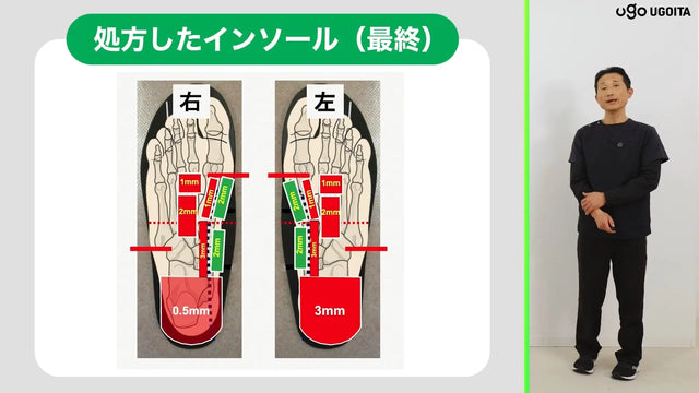 【症例】臼蓋形成不全で鼡径部と大腿内側から膝に痛みのある症例の評価と治療 スクリーンショット