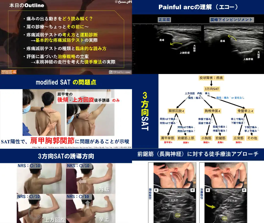 12.19 【小林弘幸先生】肩関節の痛みを正確に診る!痛みの評価と疼痛減弱テストを活用した臨床アプローチ(リピート配信)
