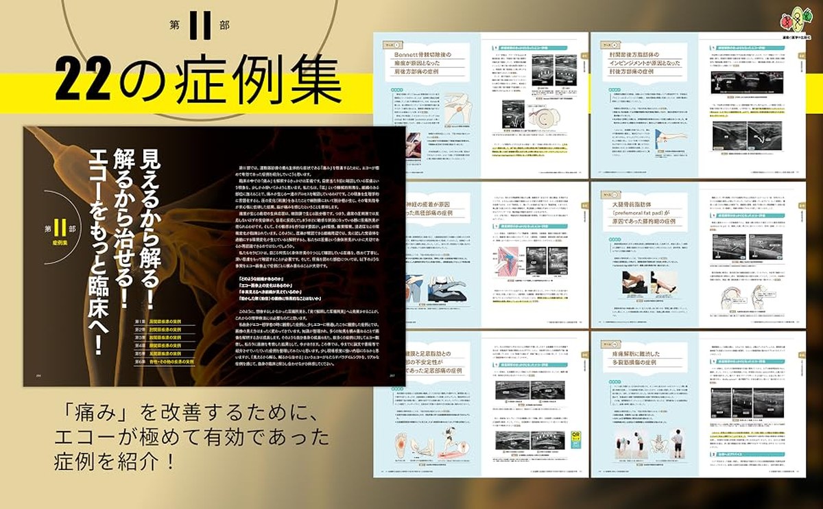 第Ⅱ部 見えるから解る!解るから治せる! エコーをもっと臨床へ!