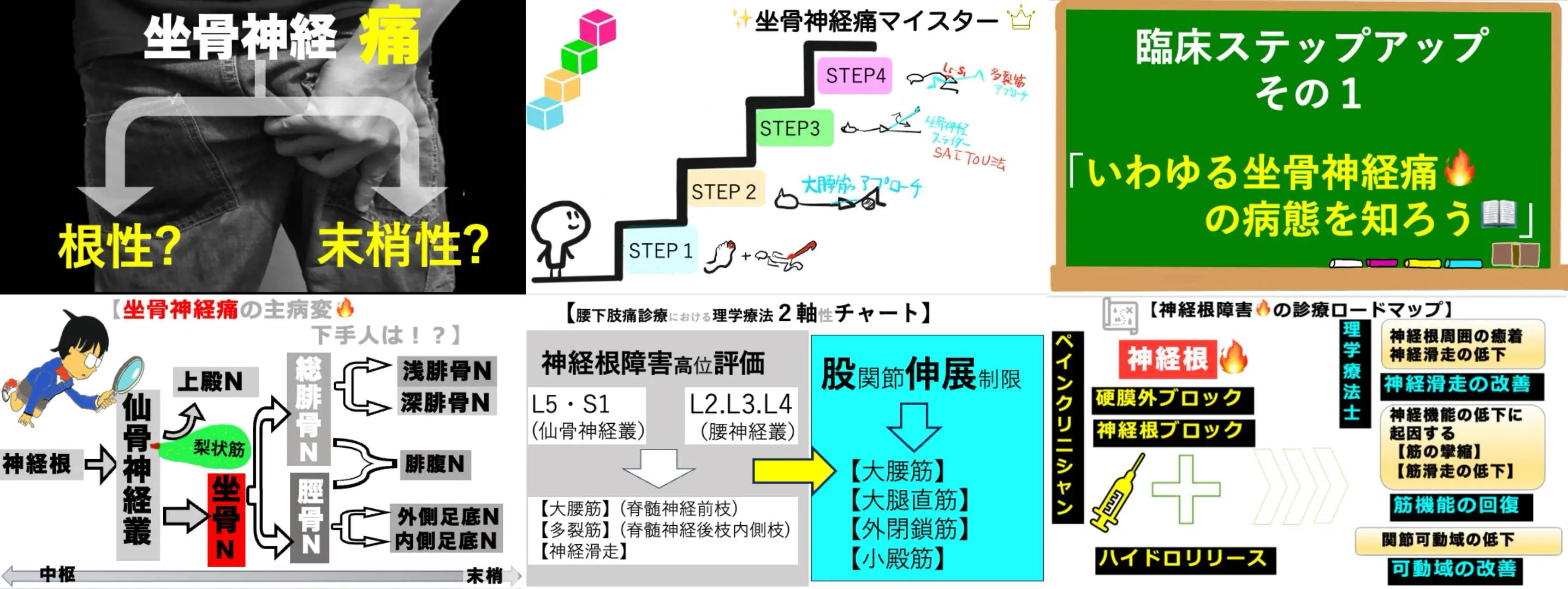 11.21【岡本光司先生・宮田徹先生】坐骨神経×腰下肢痛：筋力評価が新たな扉を開く（リピート配信）