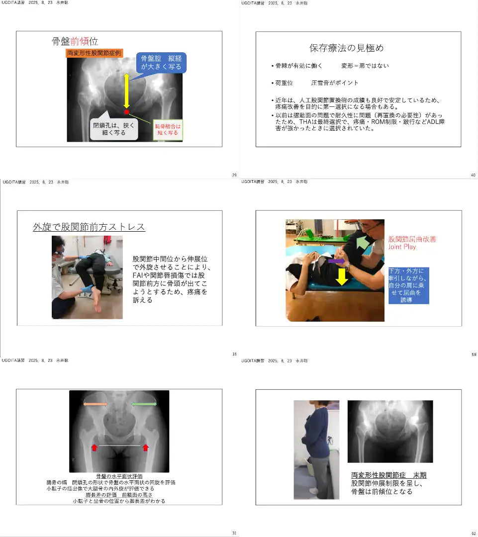 08.23【永井聡先生】外来整形外科で多い股関節障害に対する評価と運動療法～障害の主要因を改善する！局所治療編～（LIVEセミナー/ZOOM）