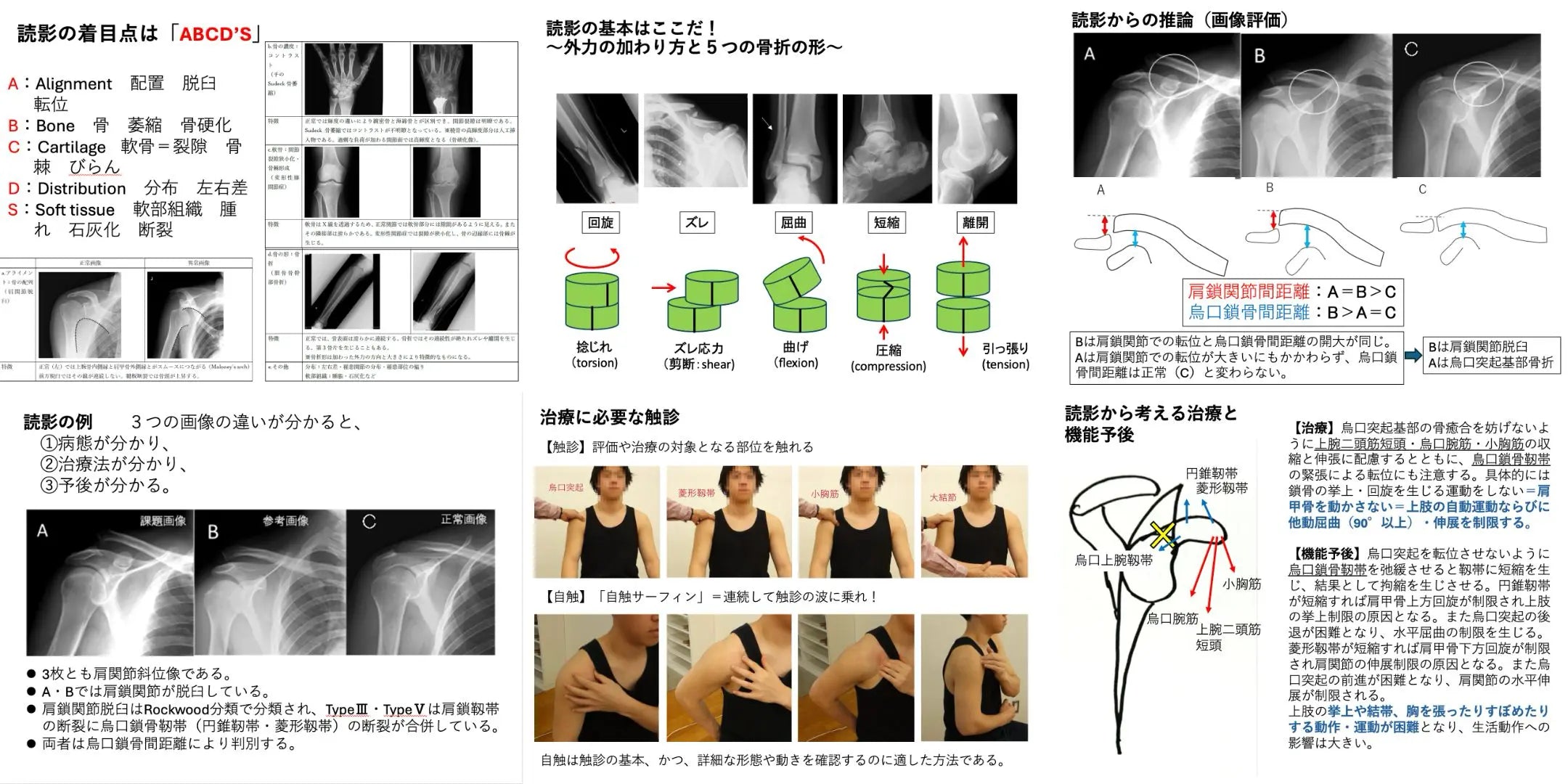 09.05【浅野昭裕先生】臨床における運動器の画像読影×組織の触診〜疾患別に考える画像所見と触診から分かること〜　上肢編（リピート配信）