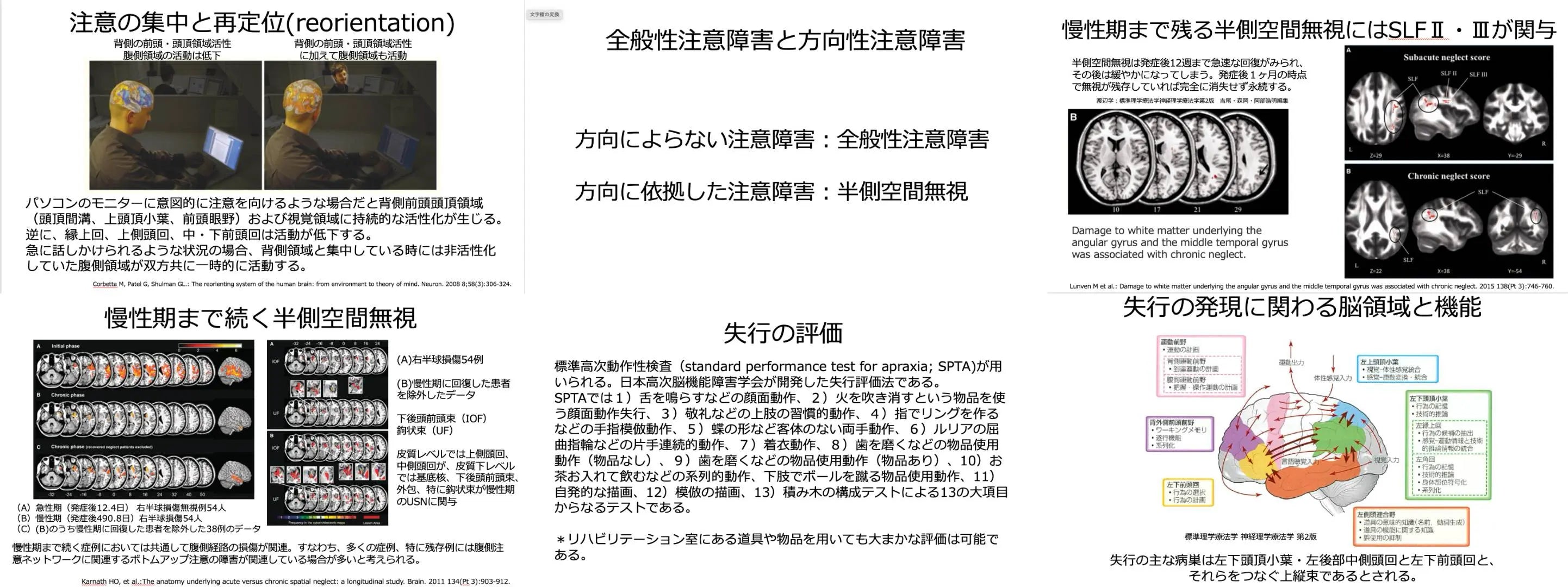 10.31【阿部浩明先生】認識できないことに伴う各種障害の理解 〜半側空間無視編〜・麻痺や感覚障害では説明できない行為の障害の理解 〜失行編〜（リピート配信）