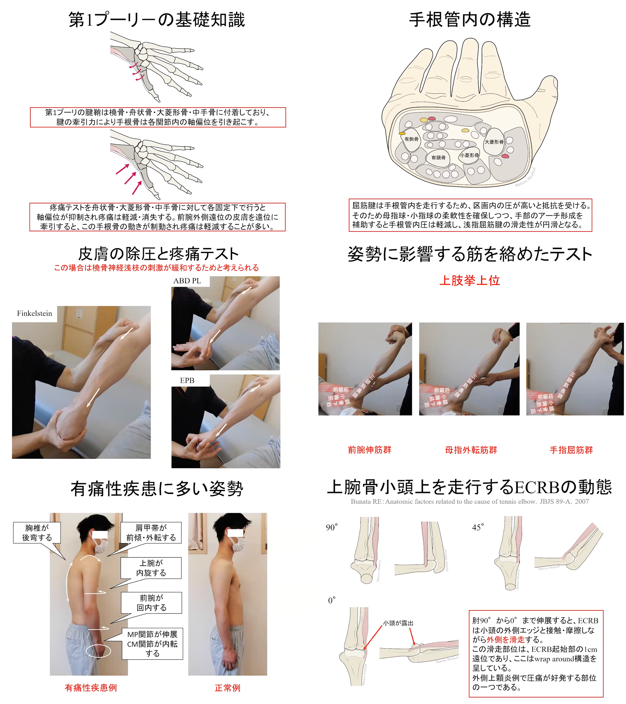 09.26【赤羽根良和先生】赤羽根良和先生は肘・前腕・手関節の有痛性疾患はこう見てこう改善させる（リピート配信）