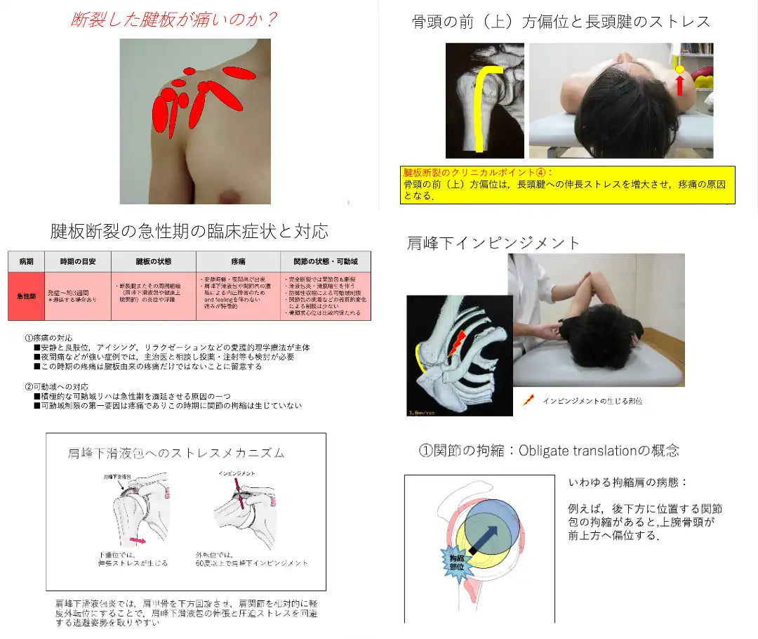 08.30【勝木秀治先生】腱板断裂に対する理学療法　疼痛と可動域制限の解釈とその対応（LIVEセミナー/ZOOM）