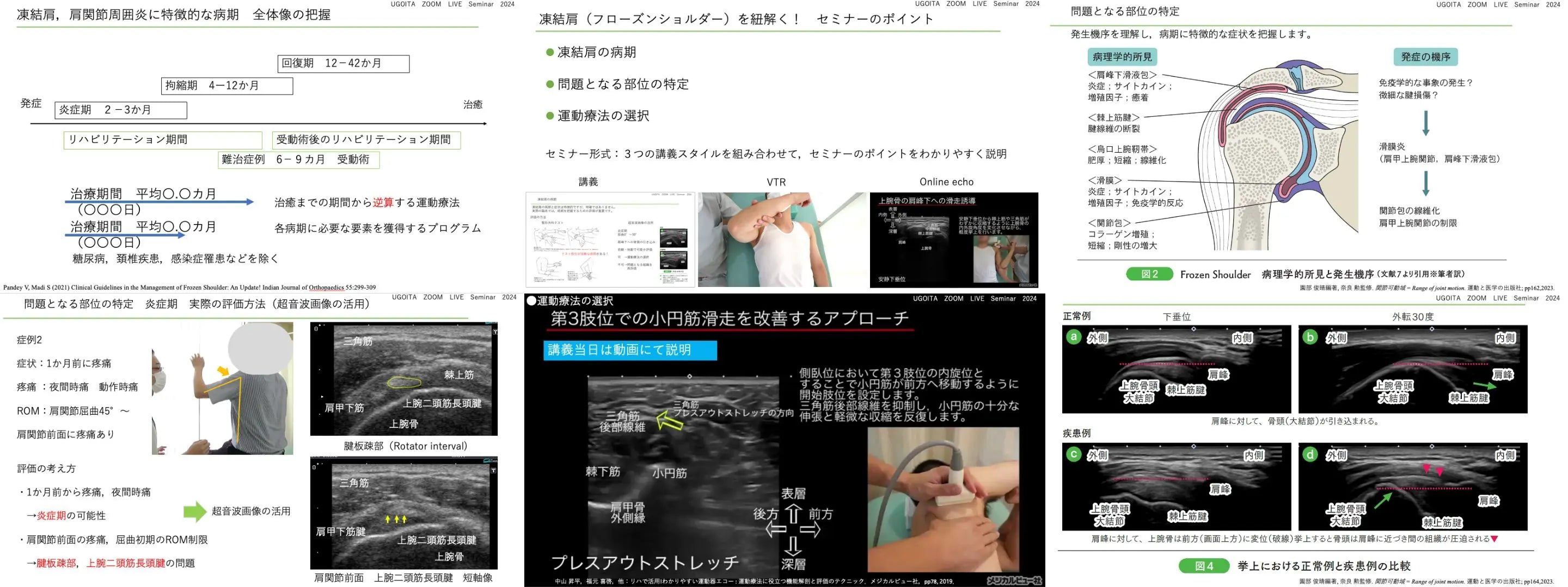 11.14【中山昇平先生】凍結肩（フローズンショルダー）を紐解く！肩関節の運動療法を効果的にする（リピート配信）
