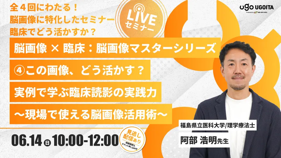 06.14 【阿部浩明先生】脳画像 × 臨床：脳画像マスターシリーズ2026 ④この画像、どう活かす？実例で学ぶ臨床読影の実践力　〜現場で使える脳画像活用術〜（LIVEセミナー/ZOOM）